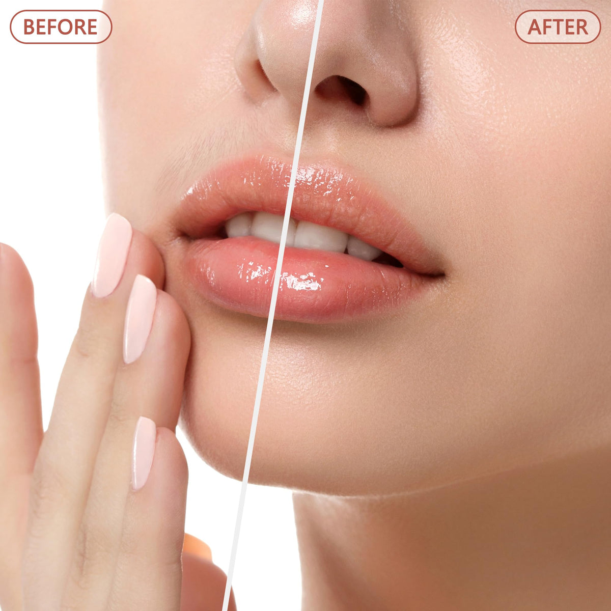 Facial Hair Remover U2304
